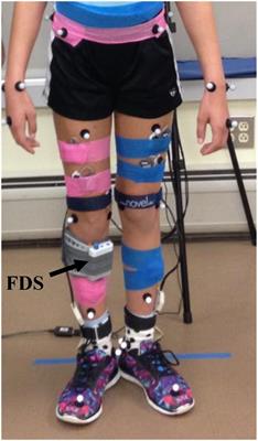 Kinematic and Functional Gait Changes After the Utilization of a Foot Drop Stimulator in Pediatrics